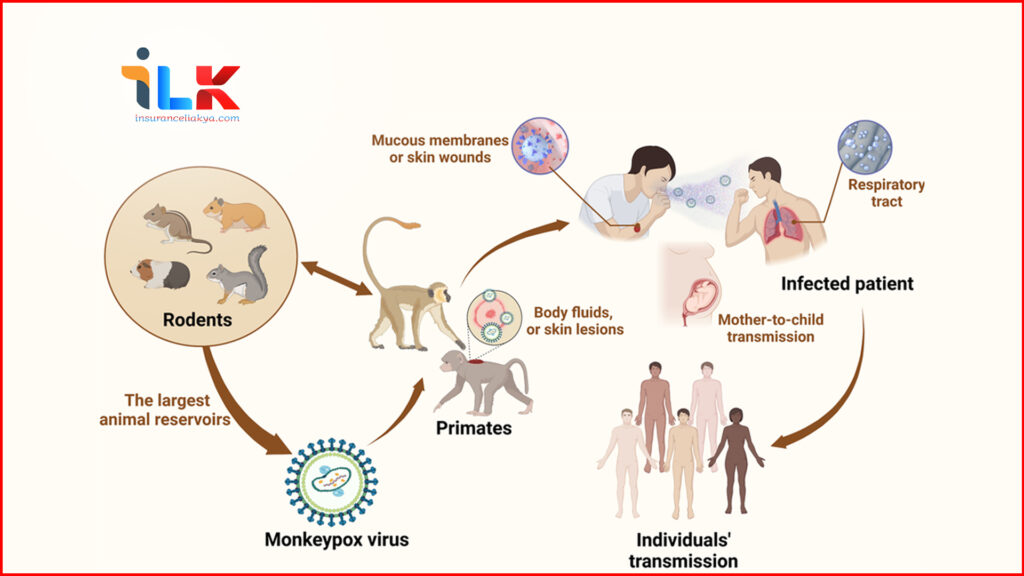 Monkeypox Symptoms 